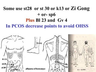 Some use st28 or st 30 or k13 or Zi Gong
+ or- sp6
Plus Bl 23 and Gv 4
In PCOS decrease points to avoid OHSS
 