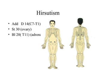 Hirsutism
• Add D 14(C7-T1),
• St 30 (ovary)
• Bl 20( T11) (adrenal)
 