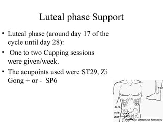 Luteal phase Support
• Luteal phase (around day 17 of the
cycle until day 28):
• One to two Cupping sessions
were given/week.
• The acupoints used were ST29, Zi
Gong + or - SP6
 