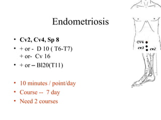 Endometriosis
• Cv2, Cv4, Sp 8
• + or - D 10 ( T6-T7)
+ or- Cv 16
• + or – Bl20(T11)
• 10 minutes / point/day
• Course -- 7 day
• Need 2 courses
 