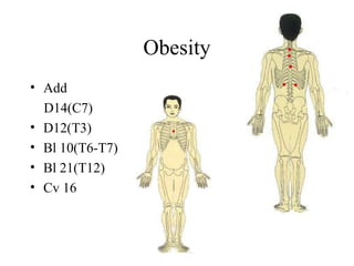 Obesity
• Add
D14(C7)
• D12(T3)
• Bl 10(T6-T7)
• Bl 21(T12)
• Cv 16
 