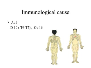 Immunological cause
• Add
D 10 ( T6-T7) , Cv 16
 