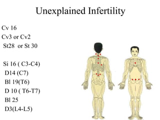 Unexplained Infertility
Cv 16
Cv3 or Cv2
St28 or St 30
Si 16 ( C3-C4)
D14 (C7)
Bl 19(T6)
D 10 ( T6-T7)
Bl 25
D3(L4-L5)
 