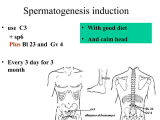 Spermatogenesis induction
• use C3
+ sp6
Plus Bl 23 and Gv 4
• Every 3 day for 3
month
• With good diet
• And calm head
 