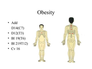 Obesity
• Add
D14(C7)
• D12(T3)
• Bl 19(T6)
• Bl 219T12)
• Cv 16
 