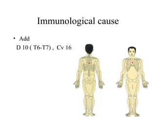 Immunological cause
• Add
D 10 ( T6-T7) , Cv 16
 