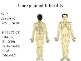 Unexplained Infertility
Cv 16
Cv3 or Cv2
St28 or St 30
Si 16 ( C3-C4)
D14 (C7)
Bl 19(T6)
D 10 ( T6-T7)
Bl 25
D3(L4-L5)
 