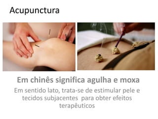 Acupunctura
Em chinês significa agulha e moxa
Em sentido lato, trata-se de estimular pele e
tecidos subjacentes para obter efeitos
terapêuticos
 