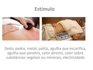 Estímulo
Dedo, pedra, metal, palito, agulha que escarifica,
agulha que penetra, calor directo, calor sobre
substâncias vegetais ou minerais, electricidade
 