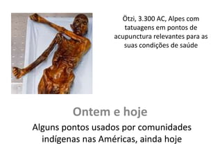 Ontem e hoje
Alguns pontos usados por comunidades
indígenas nas Américas, ainda hoje
Ötzi, 3.300 AC, Alpes com
tatuagens em pontos de
acupunctura relevantes para as
suas condições de saúde
 