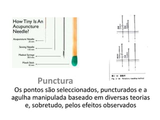 Punctura
Os pontos são seleccionados, puncturados e a
agulha manipulada baseado em diversas teorias
e, sobretudo, pelos efeitos observados
 
