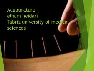 Acupuncture
elham heidari
Tabriz university of medical
sciences
 