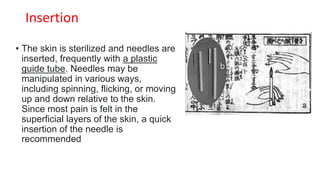 • The skin is sterilized and needles are
inserted, frequently with a plastic
guide tube. Needles may be
manipulated in various ways,
including spinning, flicking, or moving
up and down relative to the skin.
Since most pain is felt in the
superficial layers of the skin, a quick
insertion of the needle is
recommended
Insertion
 