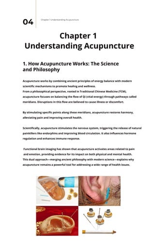 Acupuncture: Pathway to a Healthier Life | PDF