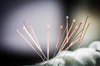 Needles use in Acupuncture Therapy