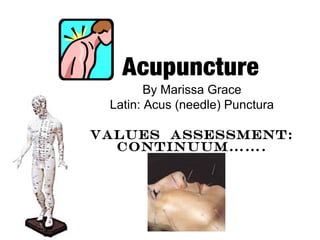 By Marissa Grace
Latin: Acus (needle) Punctura
Values Assessment:
Continuum…….
 