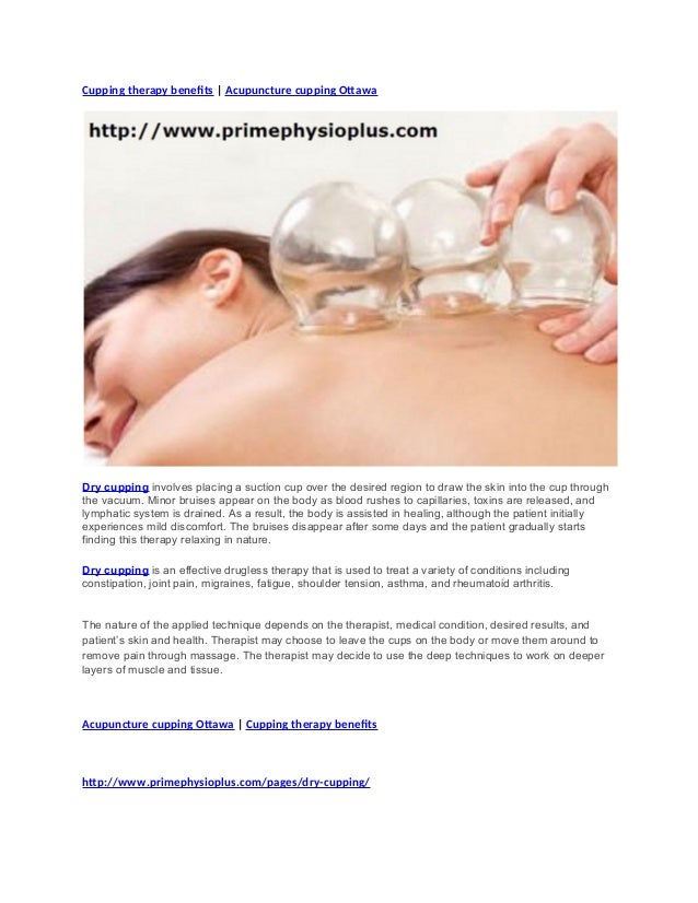 Cupping therapy benefits Acupuncture cupping Ottawa