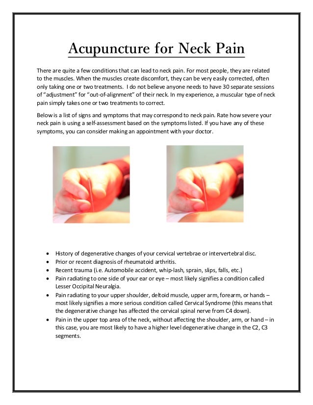Acupuncture for Neck Pain