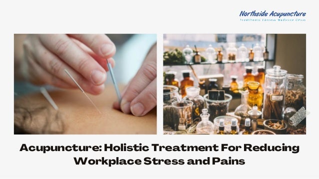 Acupuncture: Holistic Treatment For Reducing
Workplace Stress and Pains
 