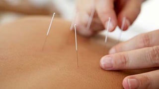 Alzheimer’s And Acupuncture: An Integrative Medicine To Lower Hospital Time