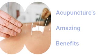 Acupuncture's Amazing Benefits