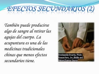 EFECTOS SECUNDARIOS (2)También puede producirse algo de sangre al retirar las agujas del cuerpo. La acupuntura es una de las medicinas tradicionales chinas que menos efectos secundarios tiene.