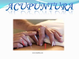 acupuntura www.vitadelia.com 