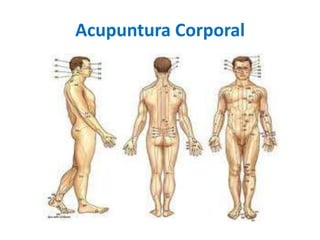 Acupuntura Corporal

 