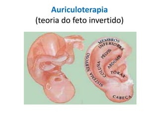 Auriculoterapia
(teoria do feto invertido)

 
