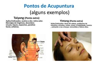 Pontos de Acupuntura
(alguns exemplos)
Taiyang (Ponto extra)
Ações/indicações: acalma a dor, retira calor.
Nevralgia do trigémeo, desordens
visuais, tiques, espasmos, paralisia
facial, cefaleias.

Yintang (Ponto extra)
Ações/indicações: dores de cabeça, problemas de
memória, sinusites, rinites, stress, irritabilidade, insónia
, calmante e nas crianças: convulsões e febres altas.

 