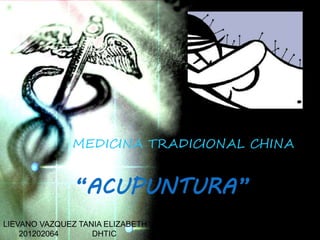 MEDICINA TRADICIONAL CHINA
“ACUPUNTURA”
LIEVANO VAZQUEZ TANIA ELIZABETH
201202064 DHTIC
 