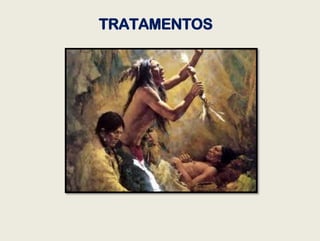 TRATAMENTOS
 