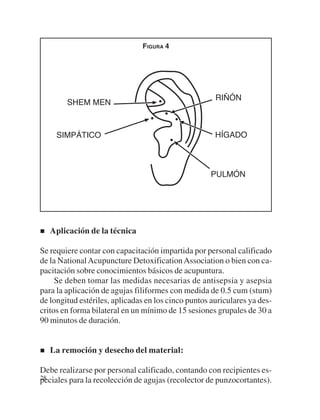 FIGURA 4




   Aplicación de la técnica

Se requiere contar con capacitación impartida por personal calificado
de la National Acupuncture Detoxification Association o bien con ca-
pacitación sobre conocimientos básicos de acupuntura.
     Se deben tomar las medidas necesarias de antisepsia y asepsia
para la aplicación de agujas filiformes con medida de 0.5 cum (stum)
de longitud estériles, aplicadas en los cinco puntos auriculares ya des-
critos en forma bilateral en un mínimo de 15 sesiones grupales de 30 a
90 minutos de duración.


   La remoción y desecho del material:

Debe realizarse por personal calificado, contando con recipientes es-
28
peciales para la recolección de agujas (recolector de punzocortantes).
 