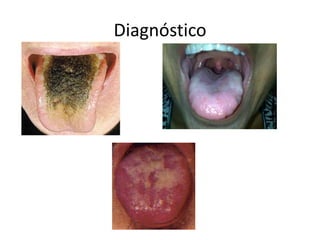 Diagnóstico
 