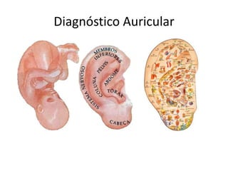 Diagnóstico Auricular
 