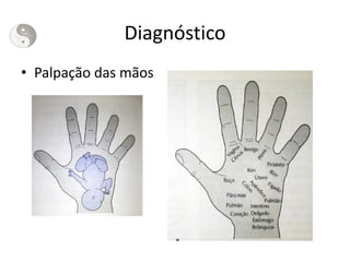 Diagnóstico
• Palpação das mãos
 