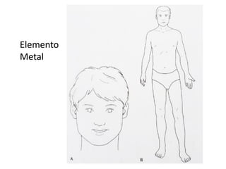 Elemento
Metal
 