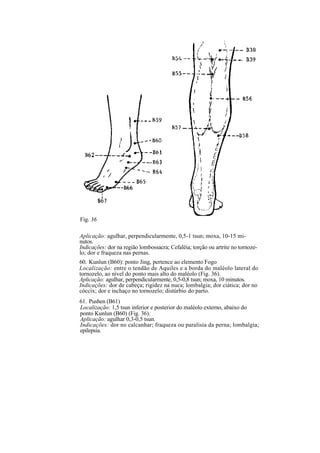 Fig. 36
Aplicação: agulhar, perpendicularmente, 0,5-1 tsun; moxa, 10-15 mi-
nutos.
Indicações: dor na região lombossacra; Cefaléia; torção ou artrite no tornoze-
lo; dor e fraqueza nas pernas.
60. Kunlun (B60): ponto Jing, pertence ao elemento Fogo
Localização: entre o tendão de Aquiles e a borda do maléolo lateral do
tornozelo, ao nível do ponto mais alto do maléolo (Fig. 36).
Aplicação: agulhar, perpendicularmente, 0,5-0,8 tsun; moxa, 10 minutos.
Indicações: dor de cabeça; rigidez na nuca; lombalgia; dor ciática; dor no
cóccix; dor e inchaço no tornozelo; distúrbio do parto.
61. Pushen (B61)
Localização: 1,5 tsun inferior e posterior do maléolo externo, abaixo do
ponto Kunlun (B60) (Fig. 36).
Aplicação: agulhar 0,3-0,5 tsun.
Indicações: dor no calcanhar; fraqueza ou paralisia da perna; lombalgia;
epilepsia.
 