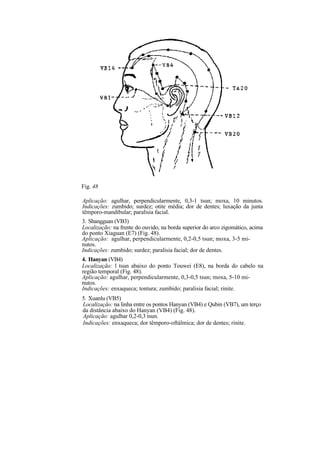 Fig. 48
Aplicação: agulhar, perpendicularmente, 0,3-1 tsun; moxa, 10 minutos.
Indicações: zumbido; surdez; otite média; dor de dentes; luxação da junta
têmporo-mandibular; paralisia facial.
3. Shangguan (VB3)
Localização: na frente do ouvido, na borda superior do arco zigomático, acima
do ponto Xiaguan (E7) (Fig. 48).
Aplicação: agulhar, perpendicularmente, 0,2-0,5 tsun; moxa, 3-5 mi-
nutos.
Indicações: zumbido; surdez; paralisia facial; dor de dentes.
4. Hanyan (VB4)
Localização: l tsun abaixo do ponto Touwei (E8), na borda do cabelo na
região temporal (Fig. 48).
Aplicação: agulhar, perpendicularmente, 0,3-0,5 tsun; moxa, 5-10 mi-
nutos.
Indicações: enxaqueca; tontura; zumbido; paralisia facial; rinite.
5. Xuanlu (VB5)
Localização: na linha entre os pontos Hanyan (VB4) e Qubin (VB7), um terço
da distância abaixo do Hanyan (VB4) (Fig. 48).
Aplicação: agulhar 0,2-0,3 tsun.
Indicações: enxaqueca; dor têmporo-oftálmica; dor de dentes; rinite.
 