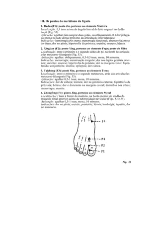 III. Os pontos do meridiano do fígado
1. Dadun(F1): ponto Jin, pertence ao elemento Madeira
Localização: 0,1 tsun acima do ângulo lateral do leito ungueal do dedão
do pé (Fig. 53).
Aplicação: agulhar para sangrar duas gotas, ou obliquamente, 0,1-0,2 polega-
da; moxa no lado dorsal próximo da articulação interfalangeal.
Indicações: hemorragia pós-parto; menorragia funcional; amenorréia; ptose
do útero; dor no pênis; hipertrofia da próstata; uretrite; enurese; hérnia.
2. Xingjian (F2): ponto Ying, pertence ao elemento Fogo; ponto de Filho
Localização: entre o primeiro e o segundo dedos do pé, na frente das articula-
ções metatarso-falangeais (Fig. 53).
Aplicação: agulhar, obliquamente, 0,3-0,5 tsun; moxa, 10 minutos.
Indicações: menorragia; menstruação irregular; dor nos órgãos genitais exter-
nos; uretrites; enurese; hipertrofia da próstata; dor na margem costal; hiper-
tensão; conjuntivite; insônia; epilepsia; dor ciática.
3. Taichong (F3): ponto Shu, pertence ao elemento Terra
Localização: entre o primeiro e o segundo metatarsos, atrás das articulações
metatarso-falangeais (Fig. 53).
Aplicação: agulhar 0,5-1 tsun; moxa, 10 minutos.
Indicações: dor de cabeça; tontura; dor na genitália externa; hipertrofia da
próstata; hérnia; dor e distensão na margem costal; distúrbio nos olhos;
menorragia; mastite.
4. Zhongfeng (F4): ponto Jing, pertence ao elemento Metal
Localização: l tsun à frente do maléolo, na borda medial do tendão do
músculo tibial anterior acima da tuberosidade navicular (Figs. 53 e 54).
Aplicação: agulhar 0,5-1 tsun; moxa, 10 minutos.
Indicações: dor no pênis; uretrite; prostatite; hérnia; lombalgia; hepatite; dor
no tornozelo.
Fig. 53
 