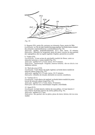 Fig. 55
8. Ququan (F8): ponto Ho, pertence ao elemento Água; ponto de Mãe
Localização: no fim do lado medial da prega poplítea, na borda ântero-medial
dos músculos semimembranoso e semitendinoso (Fig. 54).
Aplicação: agulhar, perpendicularmente, 0,5-1 tsun; moxa, 10 minutos.
Indicações: infecções no urogenital; ptose do útero; coceira na área genital;
dor suprapúbica; dor na região ingüinal; frigidez; periartrite no joelho.
9. Yinbao (F9)
Localização: 4 tsun acima do epicôndilo medial do fêmur, entre os
músculos sartorius e vastus medial (Fig. 55).
Aplicação: agulhar 0,5-1,5 tsun; moxa, 10-15 minutos.
Indicações: menstruação irregular; enurese noturna; dor no cóccix e no
abdômen inferior.
10. Wuli (da coxa) (F10)
Localização: 3 tsun abaixo da região ingüinal, na borda ântero-medial do
músculo adutor longo (Fig. 55).
Aplicação: agulhar 0,5-1,5 tsun; moxa, 10-15 minutos.
Indicações: distúrbio de micção; dermatite no escroto; sonolência.
11. Yinlian (F11)
Localização: l tsun abaixo da ingüinal; na borda ântero-medial do ponto
inicial do músculo adutor longo (Fig. 55).
Aplicação: agulhar 0,5-1,5 tsun; moxa, 10 minutos.
Indicações: dor na coxa; menstruação irregular; esterilidade.
12. Jimai (F12)
Localização: no lado lateral e inferior do osso púbico, 2,5 tsun lateral e l
tsun inferior da borda superior da sínfise púbica (Fig. 55).
Aplicação: agulhar 0,5-1 tsun.
Indicações: dor genital; dor no pênis; ptose do útero; hérnia; dor na coxa
medial.
 