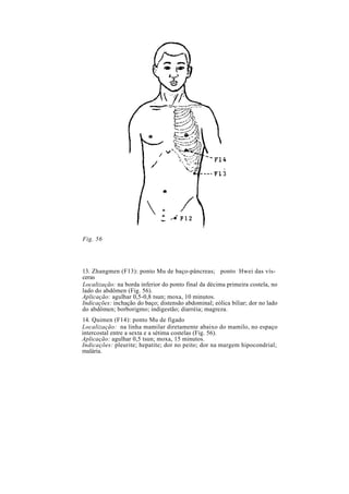 Fig. 56
13. Zhangmen (F13): ponto Mu de baço-pâncreas; ponto Hwei das vís-
ceras
Localização: na borda inferior do ponto final da décima primeira costela, no
lado do abdômen (Fig. 56).
Aplicação: agulhar 0,5-0,8 tsun; moxa, 10 minutos.
Indicações: inchação do baço; distensão abdominal; eólica biliar; dor no lado
do abdômen; borborigmo; indigestão; diarréia; magreza.
14. Quimen (F14): ponto Mu de fígado
Localização: na linha mamilar diretamente abaixo do mamilo, no espaço
intercostal entre a sexta e a sétima costelas (Fig. 56).
Aplicação: agulhar 0,5 tsun; moxa, 15 minutos.
Indicações: pleurite; hepatite; dor no peito; dor na margem hipocondrial;
malária.
 