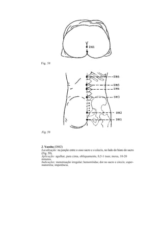 Fig. 58
Fig. 59
2. Yaoshu (DM2)
Localização: na junção entre o osso sacro e o cóccix, no lado do hiato do sacro
(Fig. 59).
Aplicação: agulhar, para cima, obliquamente, 0,5-1 tsun; moxa, 10-20
minutos.
Indicações: menstruação irregular; hemorróidas; dor no sacro e cóccix; esper-
matorréia; impotência.
 