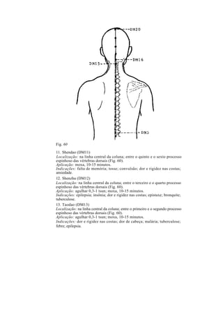 Fig. 60
11. Shendao (DM11)
Localização: na linha central da coluna; entre o quinto e o sexto processo
espinhoso das vértebras dorsais (Fig. 60).
Aplicação: moxa, 10-15 minutos.
Indicações: falta de memória; tosse; convulsão; dor e rigidez nas costas;
ansiedade.
12. Shenzhu (DM12)
Localização: na linha central da coluna; entre o terceiro e o quarto processo
espinhoso das vértebras dorsais (Fig. 60).
Aplicação: agulhar 0,3-1 tsun; moxa, 10-15 minutos.
Indicações: epilepsia; insônia; dor e rigidez nas costas; epistaxe; bronquite;
tuberculose.
13. Taodao (DM13)
Localização: na linha central da coluna; entre o primeiro e o segundo processo
espinhoso das vértebras dorsais (Fig. 60).
Aplicação: agulhar 0,3-1 tsun; moxa, 10-15 minutos.
Indicações: dor e rigidez nas costas; dor de cabeça; malária; tuberculose;
febre; epilepsia.
 