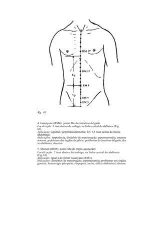 Kg. 63
4. Guanyuan (RM4): ponto Mu do intestino delgado
Localização: 3 tsun abaixo do umbigo, na linha central do abdômen (Fig.
63).
Aplicação: agulhar, perpendicularmente, 0,5-1,5 tsun acima da fáscia
abdominal.
Indicações: impotência; distúrbio de menstruação; espermatorréia; enurese
noturna; problemas dos órgãos da pélvis; problemas do intestino delgado; dor
no abdômen; diarréia.
5. Shimen (RM5): ponto Mu do triplo-aquecedor
Localização: 2 tsun abaixo do umbigo; na linha central do abdômen
(Fig. 63).
Aplicação: igual à do ponto Guanyuan (RM4).
Indicações: distúrbios de menstruação; espermatorréia; problemas nos órgãos
genitais; hemorragia pós-parto; rlispepsia; ascite; eólica abdominal; diurese.
 