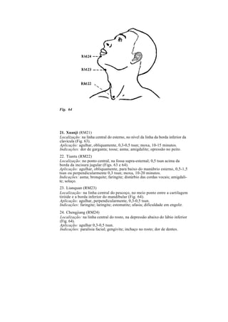 Fig. 64
21. Xuanji (RM21)
Localização: na linha central do esterno, no nível da linha da borda inferior da
clavícula (Fig. 63).
Aplicação: agulhar, obliquamente, 0,3-0,5 tsun; moxa, 10-15 minutos.
Indicações: dor de garganta; tosse; asma; amigdalite; opressão no peito.
22. Tiantu (RM22)
Localização: no ponto central, na fossa supra-esternal; 0,5 tsun acima da
borda da incisura jugular (Figs. 63 e 64).
Aplicação: agulhar, obliquamente, para baixo do manúbrio esterno, 0,5-1,5
tsun ou perpendicularmente 0,3 tsun; moxa, 10-20 minutos.
Indicações: asma; bronquite; faringite; distúrbio das cordas vocais; amigdali-
te; soluço.
23. Lianquan (RM23)
Localização: na linha central do pescoço, no meio ponto entre a cartilagem
tiróide e a borda inferior do mandibular (Fig. 64).
Aplicação: agulhar, perpendicularmente, 0,3-0,5 tsun.
Indicações: faringite; laringite; estomatite; afasia; dificuldade em engolir.
24. Chengjiang (RM24)
Localização: na linha central do rosto, na depressão abaixo do lábio inferior
(Fig. 64).
Aplicação: agulhar 0,3-0,5 tsun.
Indicações: paralisia facial; gengivite; inchaço no rosto; dor de dentes.
 
