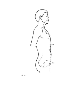 Fig. 65
 