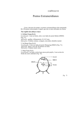 CAPÍTULO VI
Pontos Extrameridianos
Com o decorrer do tempo, os pontos extrameridianos têm aumentado.
Há 120 pontos selecionados a seguir, que são os mais utilizados na clínica.
Nas regiões da cabeça e nuca
1. Si-Shen-Tsung (Ext1)
Localização: l tsun na frente, atrás e nos lados do ponto Baihui (DM20)
(Fig. 71).
Aplicação: agulhar, obliquamente, 0,1-0,3 tsun.
Indicações: Cefaléia; tontura; vertigem; convulsão; distúrbio mental.
2. Jia-Shang-Xing (Ext2)
Localização: 3 tsun nos lados do ponto Shangxing (DM23) (Fig. 71).
Aplicação: Moxa, cerca de 30 minutos ou mais.
Indicações: Polipose nasal; rinite.
3. Dang-Yang (Ext3)
Localização: na linha vertical que passa pela pupila, l tsun acima da
borda do couro cabeludo (Fig. 72),
Fig. 71
 