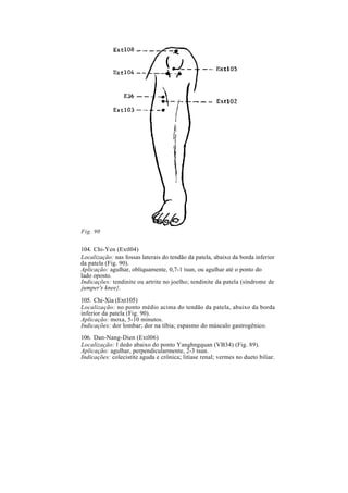 Fig. 90
104. Chi-Yen (Extl04)
Localização: nas fossas laterais do tendão da patela, abaixo da borda inferior
da patela (Fig. 90).
Aplicação: agulhar, obliquamente, 0,7-1 tsun, ou agulhar até o ponto do
lado oposto.
Indicações: tendinite ou artrite no joelho; tendinite da patela (síndrome de
jumper's knee}.
105. Chi-Xia (Ext105)
Localização: no ponto médio acima do tendão da patela, abaixo da borda
inferior da patela (Fig. 90).
Aplicação: moxa, 5-10 minutos.
Indicações: dor lombar; dor na tíbia; espasmo do músculo gastrogênico.
106. Dan-Nang-Dien (Extl06)
Localização: l dedo abaixo do ponto Yanghngquan (VB34) (Fig. 89).
Aplicação: agulhar, perpendicularmente, 2-3 tsun.
Indicações: colecistite aguda e crônica; litíase renal; vermes no dueto biliar.
 