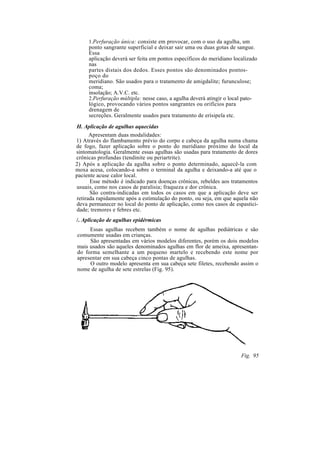 1.Perfuração única: consiste em provocar, com o uso da agulha, um
ponto sangrante superficial e deixar sair uma ou duas gotas de sangue.
Essa
aplicação deverá ser feita em pontos específicos do meridiano localizado
nas
partes distais dos dedos. Esses pontos são denominados pontos-
poço do
meridiano. São usados para o tratamento de amigdalite; furunculose;
coma;
insolação; A.V.C. etc.
2.Perfuração múltipla: nesse caso, a agulha deverá atingir o local pato-
lógico, provocando vários pontos sangrantes ou orifícios para
drenagem de
secreções. Geralmente usados para tratamento de erisipela etc.
H. Aplicação de agulhas aquecidas
Apresentam duas modalidades:
1) Através do flambamento prévio do corpo e cabeça da agulha numa chama
de fogo, fazer aplicação sobre o ponto do meridiano próximo do local da
sintomatologia. Geralmente essas agulhas são usadas para tratamento de dores
crônicas profundas (tendinite ou periartrite).
2) Após a aplicação da agulha sobre o ponto determinado, aquecê-la com
moxa acesa, colocando-a sobre o terminal da agulha e deixando-a até que o
paciente acuse calor local.
Esse método é indicado para doenças crônicas, rebeldes aos tratamentos
usuais, como nos casos de paralisia; fraqueza e dor crônica.
São contra-indicadas em todos os casos em que a aplicação deve ser
retirada rapidamente após a estimulação do ponto, ou seja, em que aquela não
deva permanecer no local do ponto de aplicação, como nos casos de espastici-
dade; tremores e febres etc.
/. Aplicação de agulhas epidérmicas
Essas agulhas recebem também o nome de agulhas pediátricas e são
comumente usadas em crianças.
São apresentadas em vários modelos diferentes, porém os dois modelos
mais usados são aqueles denominados agulhas em flor de ameixa, apresentan-
do forma semelhante a um pequeno martelo e recebendo este nome por
apresentar em sua cabeça cinco pontas de agulhas.
O outro modelo apresenta em sua cabeça sete filetes, recebendo assim o
nome de agulha de sete estrelas (Fig. 95).
Fig. 95
 